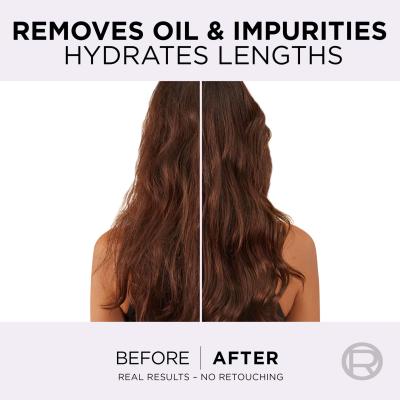 L&#039;Oréal Paris Elseve Hyaluron Pure Oil Erasing Scalp Serum Ορός μαλλιών για γυναίκες 102 ml
